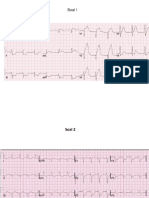 Contoh Ekg Untuk Latihan