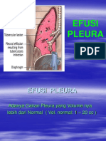 Dokumen_tips_efusi-pleura-power-point.ppt