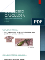 COLESISTITIS CALCULOSA