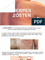 Herpes zóster y mononucleosis