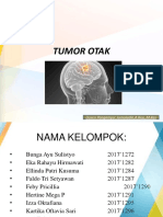 Tumor Otak