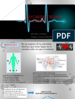 Electrocardiograma Normal