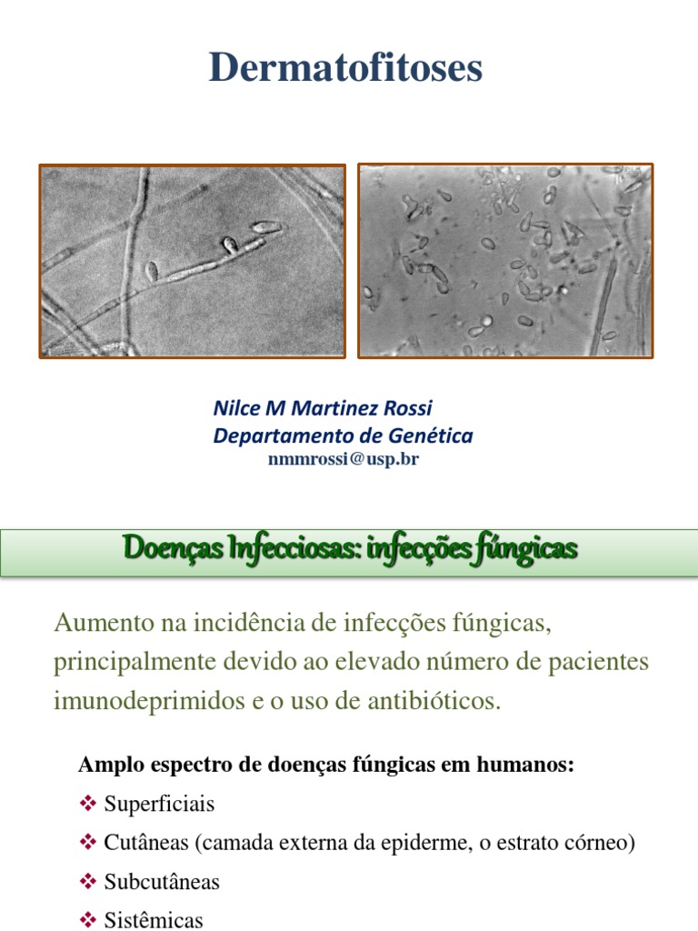 Dermatofitose: Tipos e Tratamentos | PDF | Fungo | Infecção