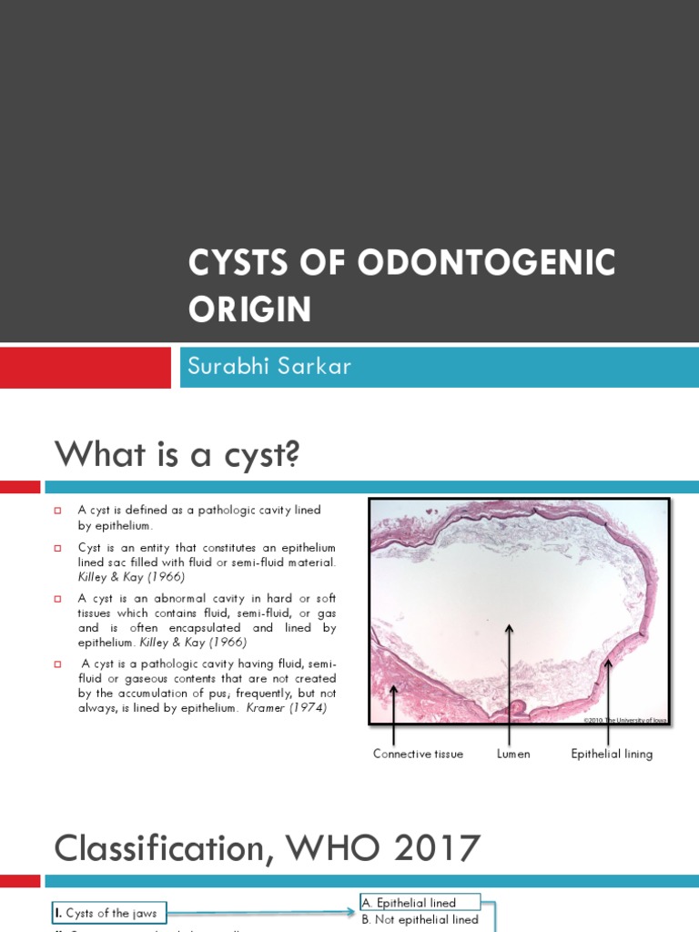 Odontogenic Cysts: Definitions and Classifications | PDF | Epithelium ...
