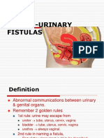 Genito-Urinary Fistulas