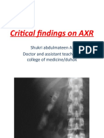 Critical Findings On AXR