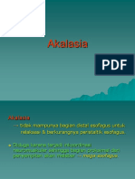 Akalasia