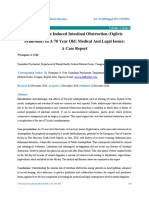 Amitryptilline Induced Intestinal Obstruction Ogilvie Syndrome in A 70 Year Old Medical and Legal Issues A Case Report