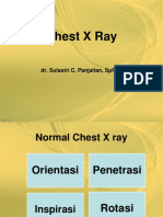 59231_chest x ray new.ppt