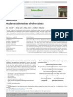 Ocular Manifestations of Tuberculosis: Sciencedirect