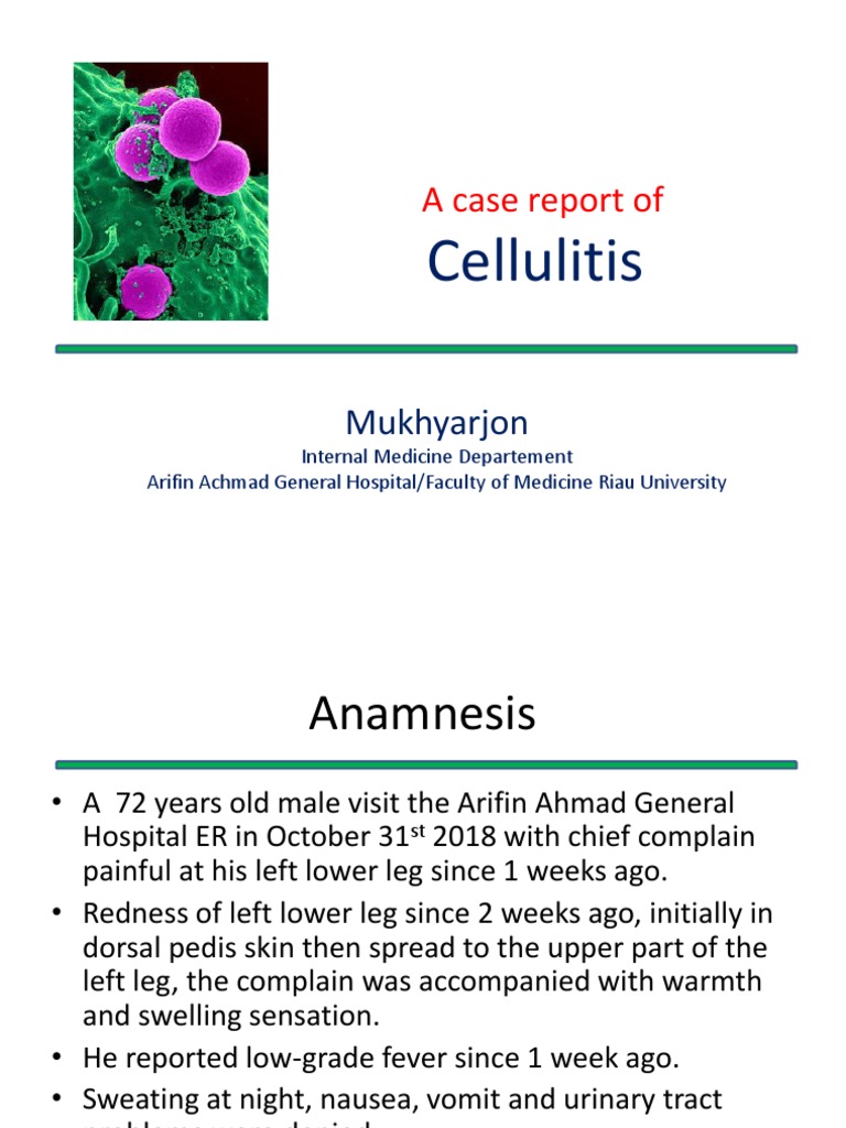Cellulitis: A Case Report of | PDF | Pulse | Clinical Medicine