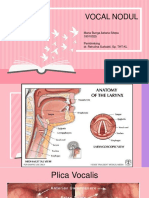 Vocal Nodule