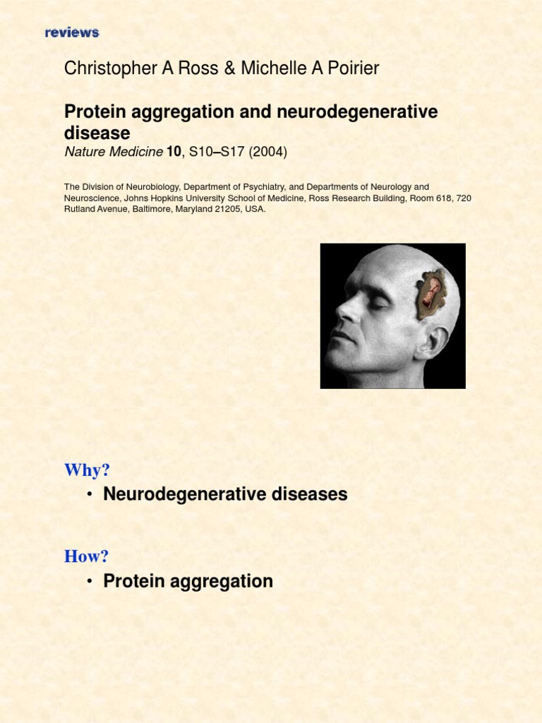 Protein Aggregation and Neurodegenerative Disease PDF Protein
