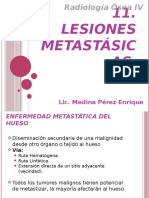 Lesiones Metastasicas