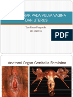 Tumor Jinak Pada Uterus Dan Vagina