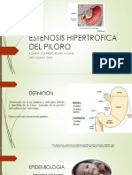 Estenosis Hipertrofica Del Piloro Yas (2)