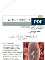 SALPINGECTOMIA.pptx