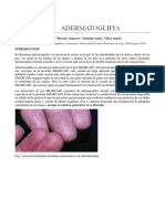 Adermatoglifia Informe