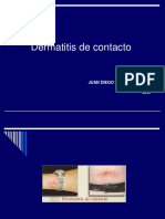 Dermatitis de Contacto