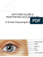 Ruptured Globe & Penetrating Ocular Injury DR Eunike Cahyaningsih, SPM, Mars