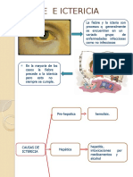 Fiebre e Ictericia