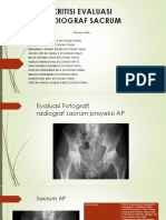 Kritisi Radiograf Sacrum