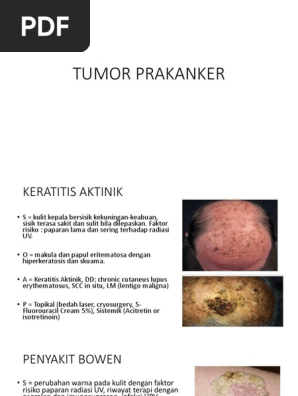 Az orrmelléküregek invertált papillomája - ENT House Budapest - Az orr papillómáinak oka