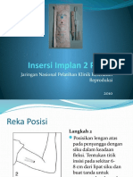Insersi Implan 2 Plus - Finalpptx
