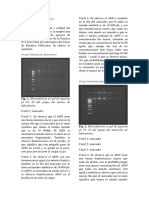 Resultados Electroforesis