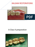 Cde-Class II Amalgam Restorations-31!12!14