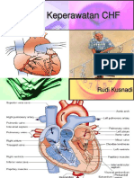 Asuhan Keperawatan CHF