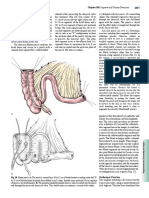 Ileal Pouches: Chapter 189: Supravesical Urinary Diversion