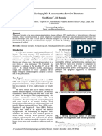 Tubuercular Laryngitis: A Case Report and Review Literature