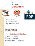 Eye Donation: Corneal Grafting