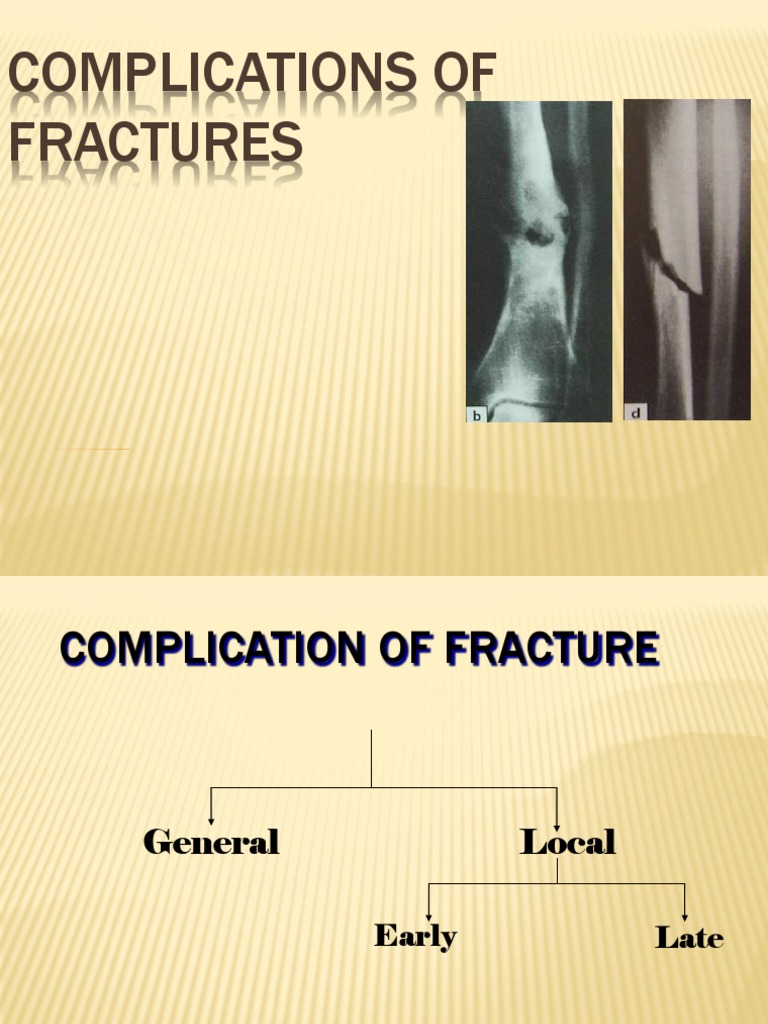 Complications of Fractures Explained | PDF | Ischemia | Wound