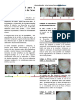 Sistema Internacional para La Detección y Evaluación de Caries