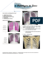 Medicina Por Imagens - Anatomia Radiológica Do Tórax