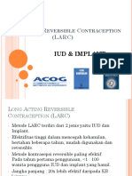 Long Acting Reversible Contraception (LARC)