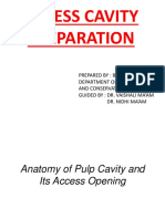 Access Cavity Preparation