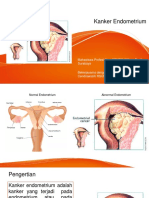 Kanker Endometrium