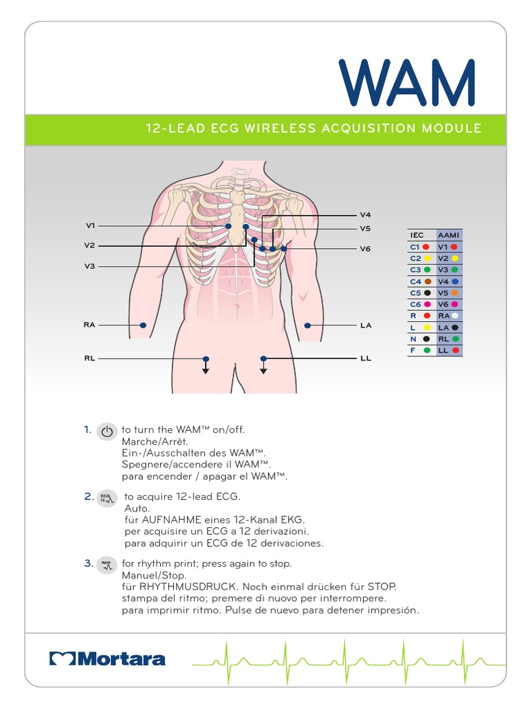 WAM Mortara Treadmill PDF Cardiac Electrophysiology