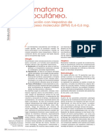 Dialnet HematomaSubcutaneo 4603346 PDF