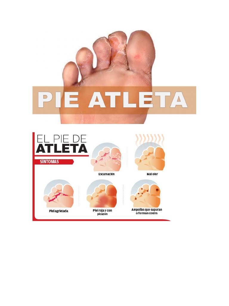 Pie de Atleta PDF