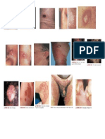 gambaran dari penyakit kulit.docx