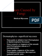 Diseases Caused by Fungi