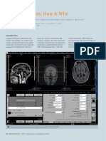 Brain Perfusion How Why-00093544