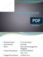 HIDRONEFROSIS