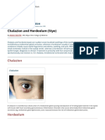 Chalazion and Hordeolum (Stye) - Eye Disorders - Merck Manuals Professional Edition