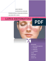 241387175-Lupus-Eritematoso-Sistemico.docx