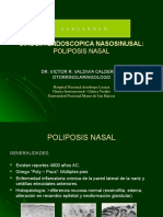 Cirugiaendoscopicaenpoliposisnasal 130214143121 Phpapp02